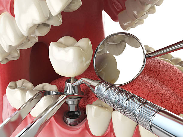 Best Broken or Cracked Tooth Emergency Dentist in Travelers Rest, SC
